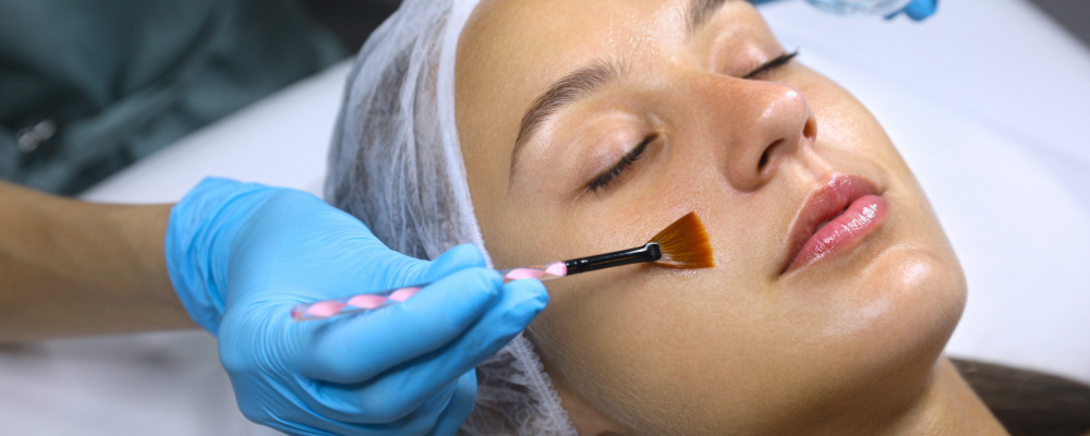 Chemical peels homepage image Whyte aesthetics