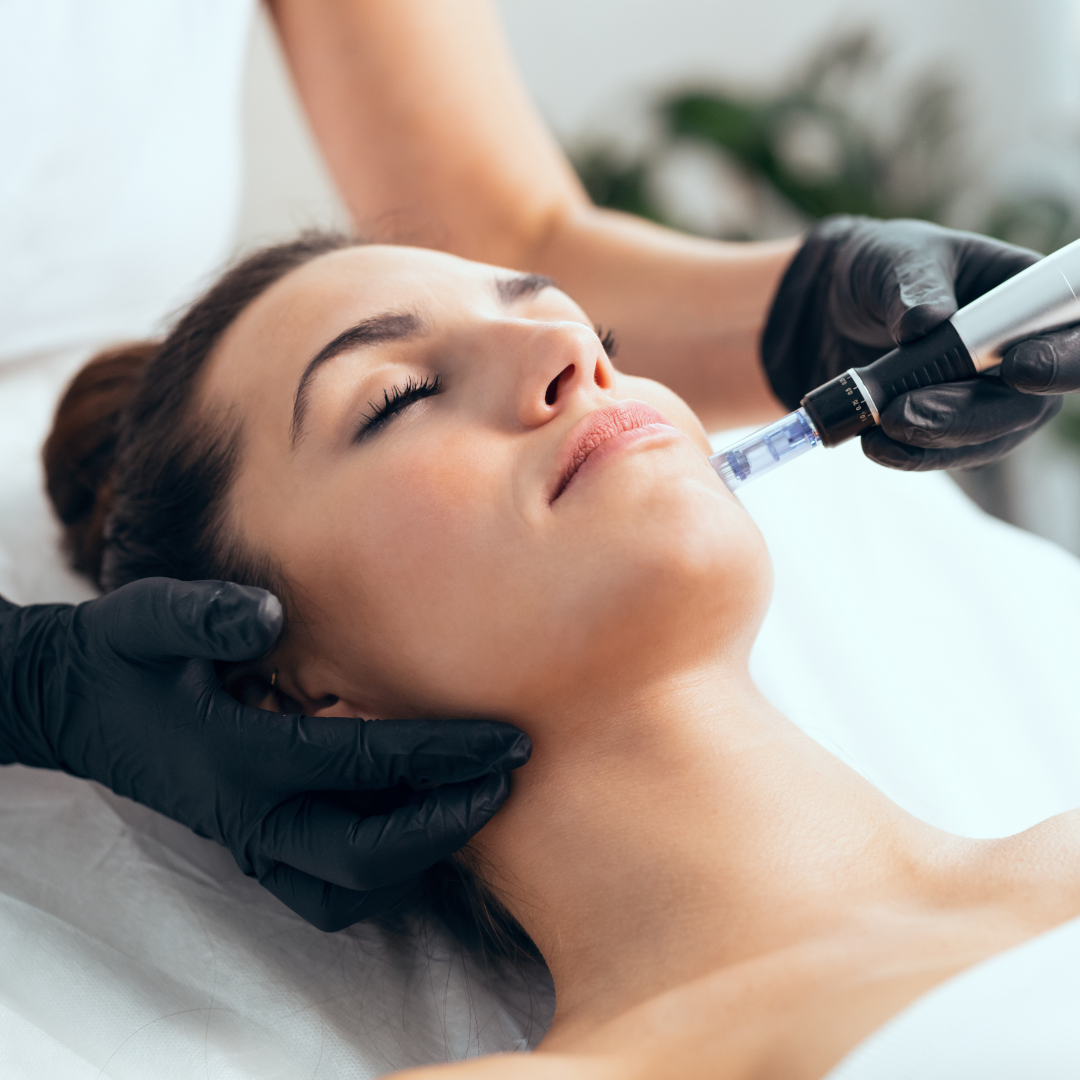 mesotherapy treatment featured image whyte aesthetics