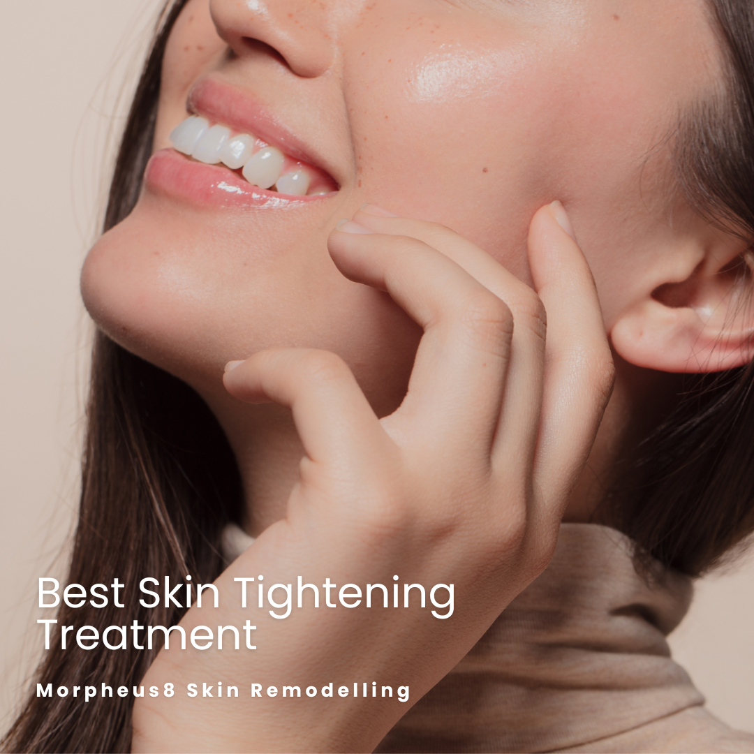 Morpheus8 best skin tightening treatment blog image whyte aesthetics