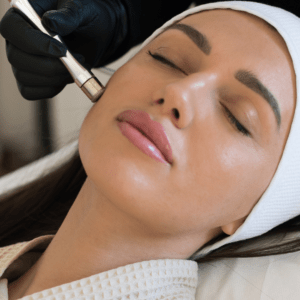 skin treatments image homepage Whyte Aesthetics